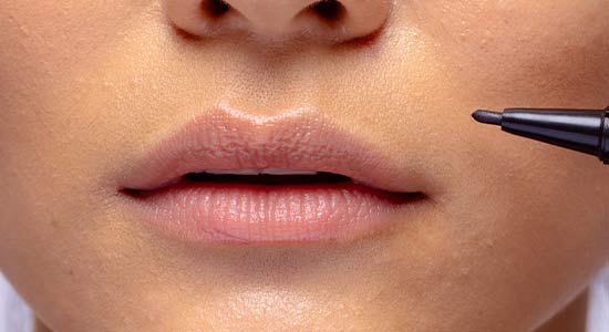 Lip Hydration & Contouring  | Dr.  Nripendra Guha